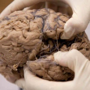 human brain